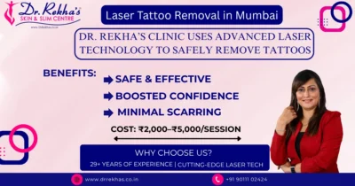 laser tattoo removal in vasai,mumbai @ Dr. Rekha's Skin and Slim Center