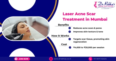 Laser acne treatment in Vasai, Mumbai at Dr. Rekha's Gastro Center